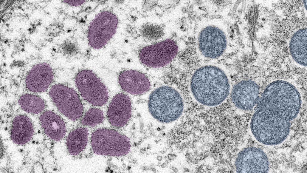 Microscopic image of monkeypox virus Click to view article, First Case of Monkeypox Identified in SLO County Resident