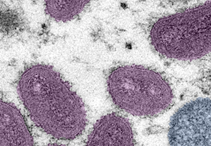 Photo of monkeypox virus